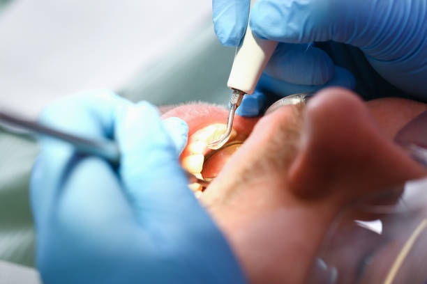 Best Root Canal Emergency Dentist  in Vla Park, IL