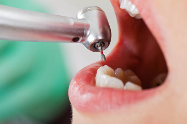 Emergency Dentist Open Today in IL